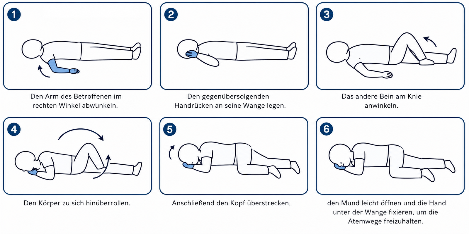 Sechs Schritte zur stabilen Seitenlage